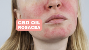 CBD olej pre rosaceu upokojuje podráždenú pokožku