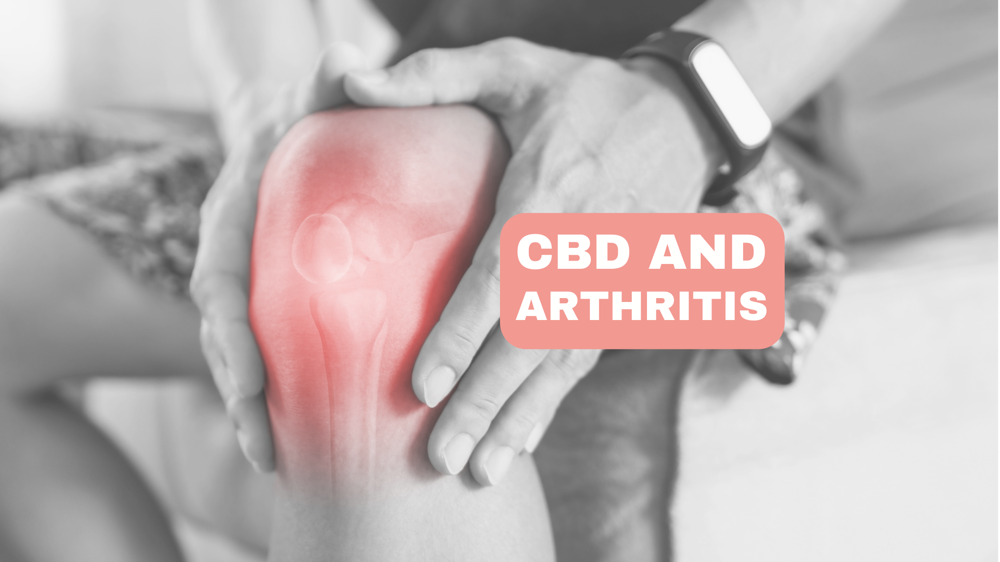 CBD and Arthritis: A study of the potential benefits of CBD for the treatment of arthritis-related pain and inflammation.