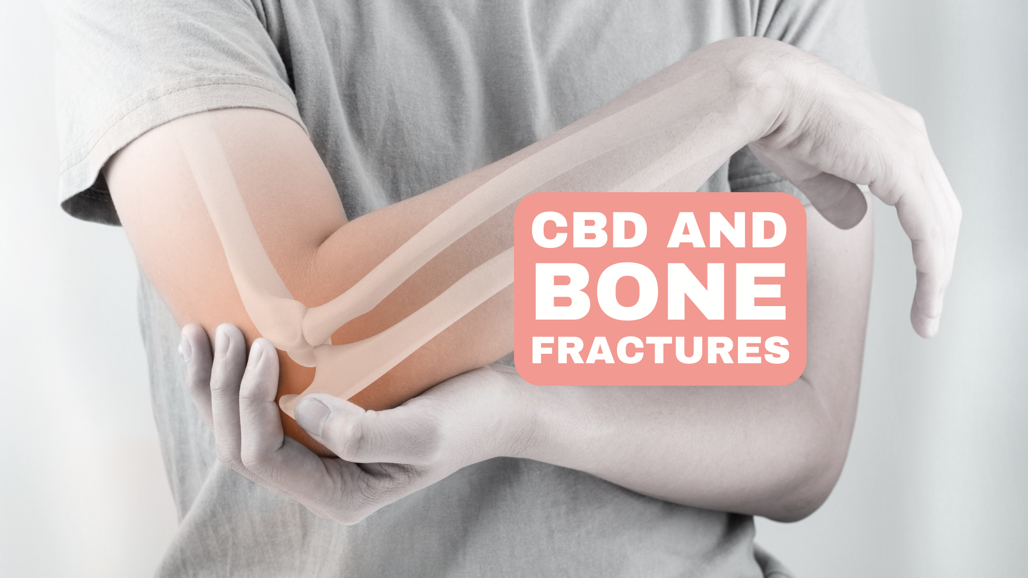 CBD and bone fractures: The potential of CBD for treating bone fractures and promoting bone healing.