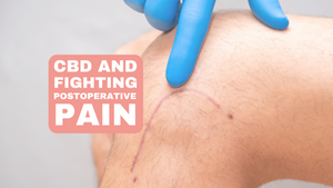 The Benefits of CBD in Postoperative Pain Management: An In-depth Study